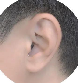 耳あな型補聴器を装着した状態の写真